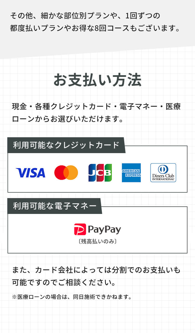 スカイなら都度払いもOK！